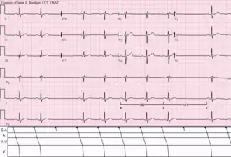 Description de l'image Type II S-A block.png.