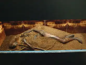 Enfant de Windeby, Allemagne.