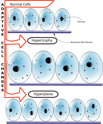 Description de l'image Hyperplasia vs Hypertrophy.svg.