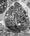 Toxoplasma gondii, microscopie électronique à transmission